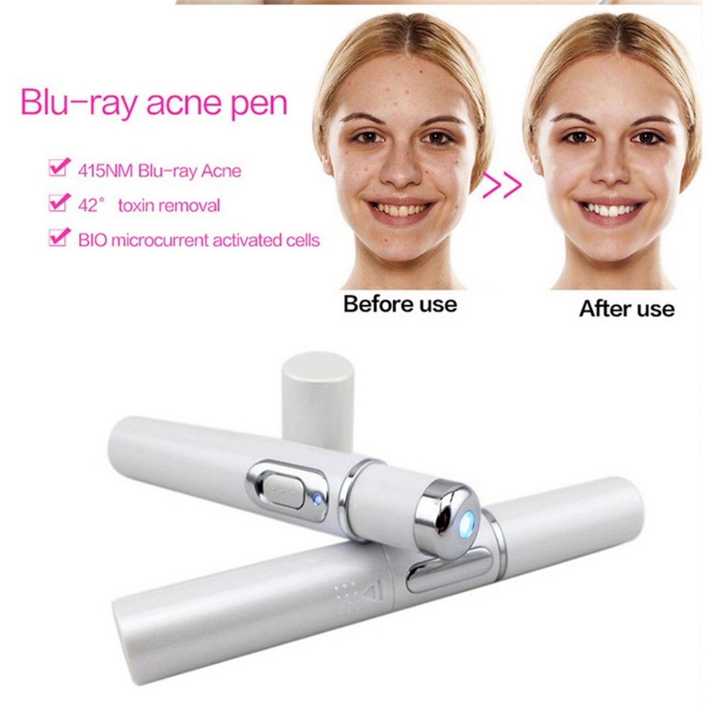 EtherealEssential™ Blue Light Therapy Laser Pen - Acne, Scar, and Wrinkle Removal Device for Flawless Skin Care