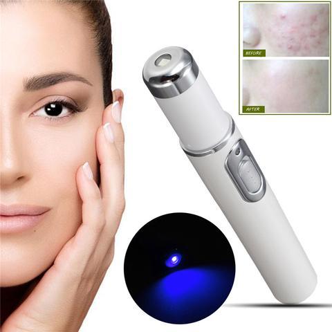 EtherealEssential™ Blue Light Therapy Laser Pen - Acne, Scar, and Wrinkle Removal Device for Flawless Skin Care